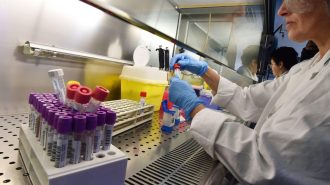Covid-19: Primera medicina basada en plasma de pacientes recuperados inicia fase clave
