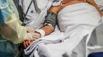 Científicos chinos encuentran vía molecular que intensifica casos críticos de Covid-19