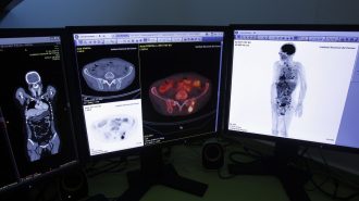 China presenta un plan de acción contra el cáncer