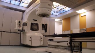 IA china ayuda a detectar el cáncer de páncreas en una fase temprana