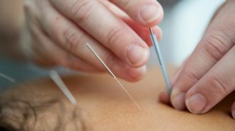 Medicina Tradicional China: Este martes habrá webinar para quienes terminaron el curso