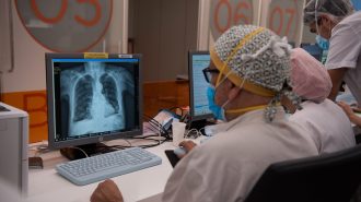 Más de un 70% de recuperados de Covid en Wuhan tuvo síntomas posteriores